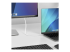 CDP2DP2MBW - 6.6 Ft. Usb C To Displayport Cable Adapter Dp To Usbc Convert - Närbild